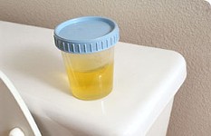 Fighting the Drug War One Urine Sample at a Time