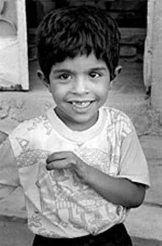 Mostafa's hand was badly damaged in a U.S. missile
strike in Basra in 2000. Shards of shrapnel were
embedded in his liver and back, most of which Iraqi
doctors were unable to remove. Mostafa received
surgery, a prosthetic glove, and post-traumatic
counseling in California in 2003.