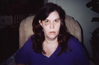 Valerie Steele says these bruises came at the hands of guards at the Travis County jail.
