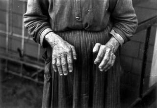 Hands of Mrs. Andrew Ostermeyer, wife of a homesteader, Miller Township, Woodbury County, Iowa, 1936