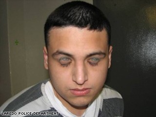 Cardona's creepy eyelid tat – please, parents, keep an eye on your kids, you really don't want little Johnny to end up like this