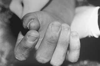 Crime scene photos showed Stacey Stites' fingernails had been roughly cut all the way to the quick, eliminating any evidence that might have been recovered from beneath them. Reed's first attorney questions whether Reed would know to remove evidence in this fashion.